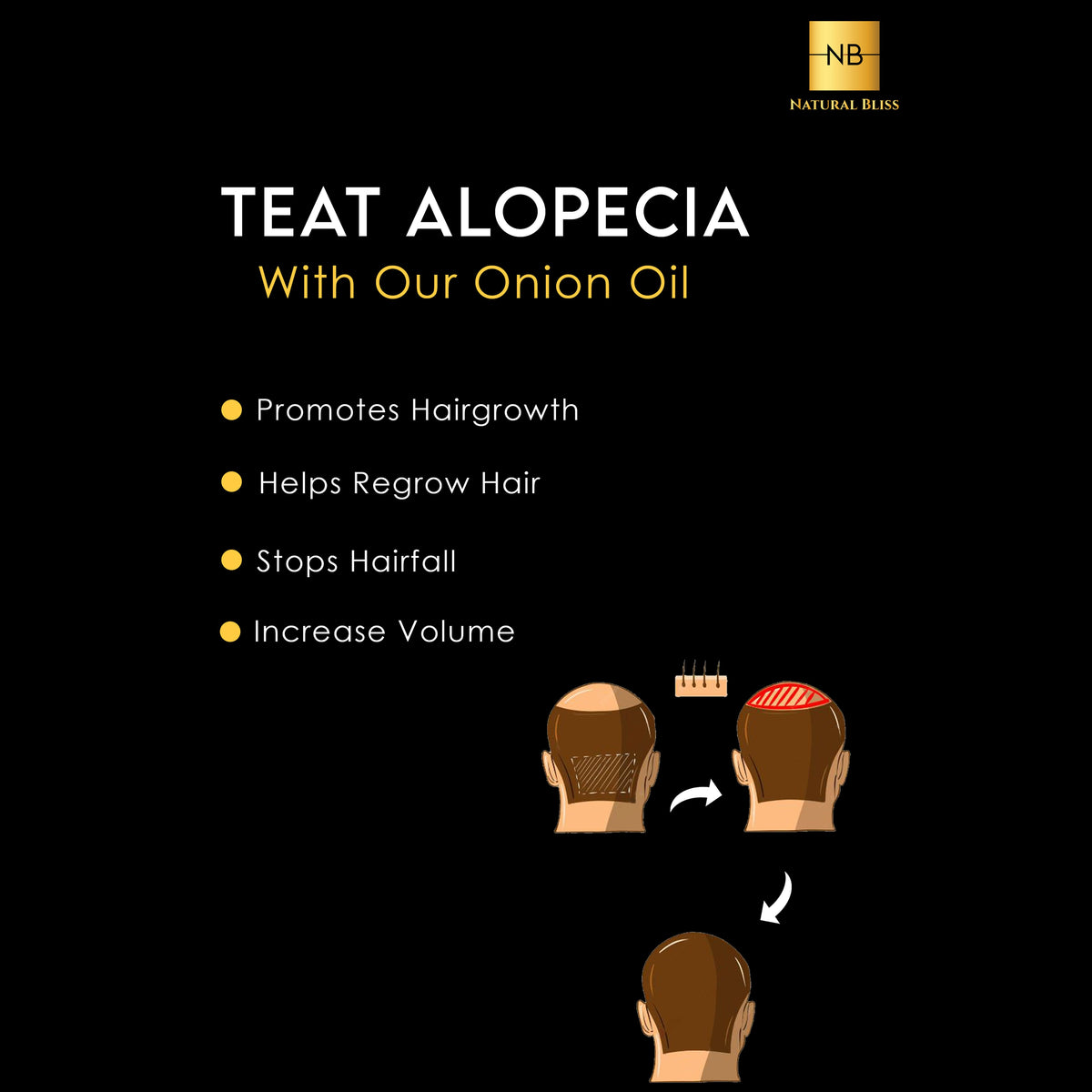 Hair Regrowth oil